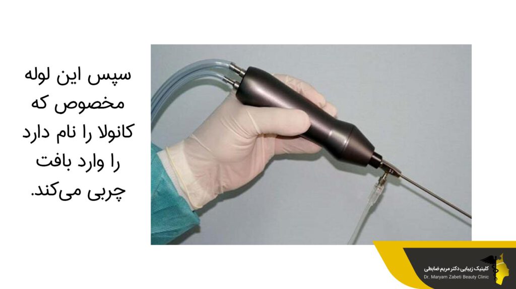 لوله کانولا