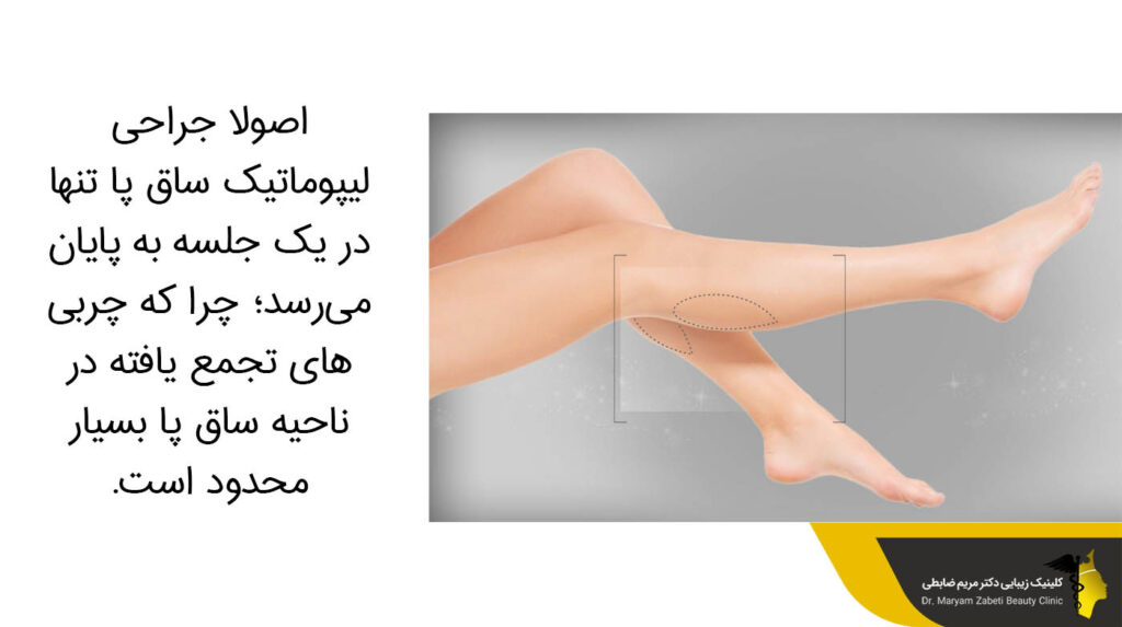 جراحی لیپوماتیک ساق پا تنها در یک جلسه به پایان می‌رسد