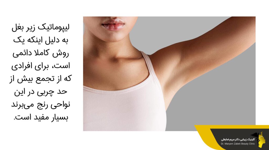 لیپوماتیک زیر بغل یک روش کاملا دائمی است