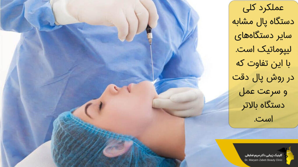 عملکرد کلی دستگاه پال 