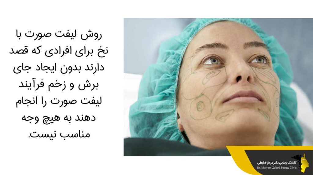 لیفت صورت با نخ 