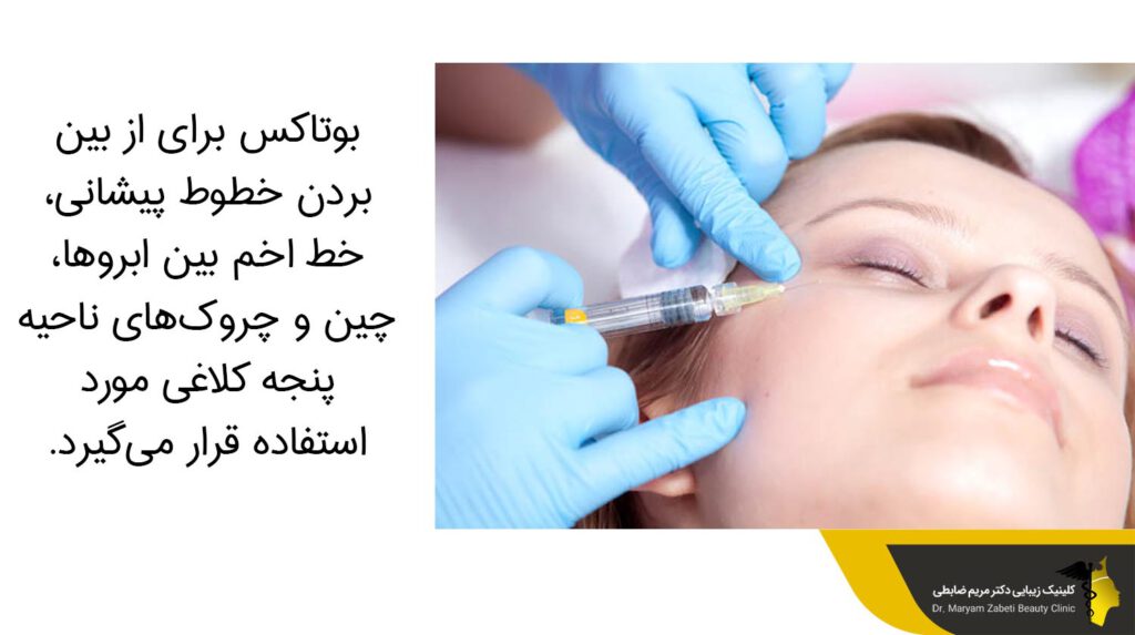 عکس بالا بردن ابرو با بوتاکس