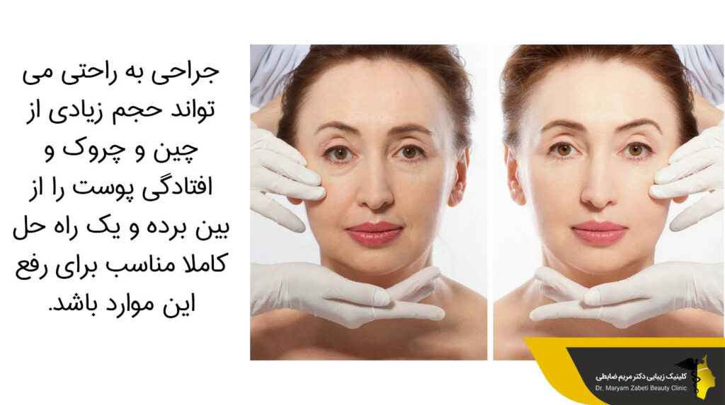 از بین بردن چین و چروک و افتادگی پوست 