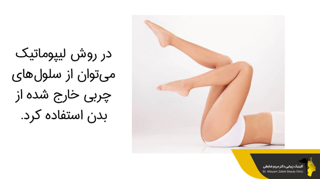 در روش لیپوماتیک ساق پا می‌توان از سلول‌های چربی خارج شده از بدن استفاده کرد