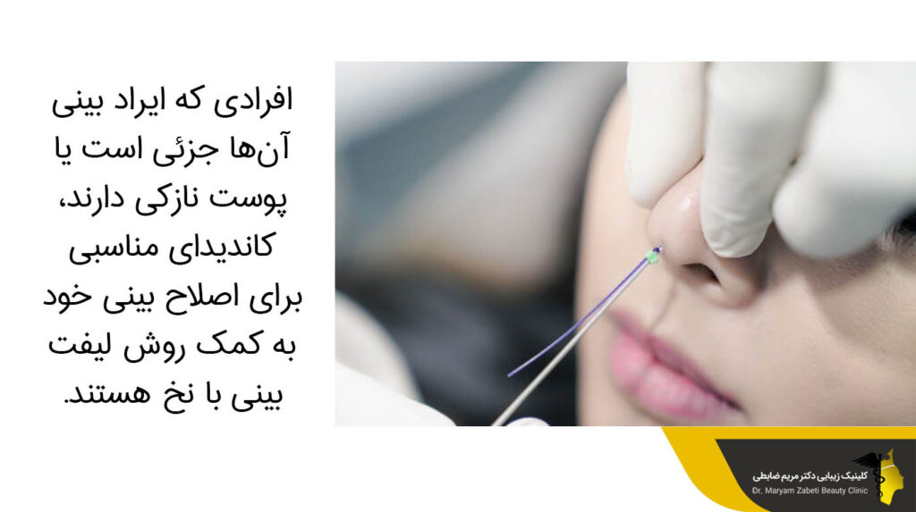 کاندیدای مناسب لیفت بینی با نخ