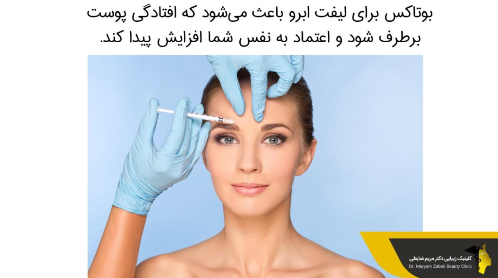 بوتاکس برای لیفت ابرو