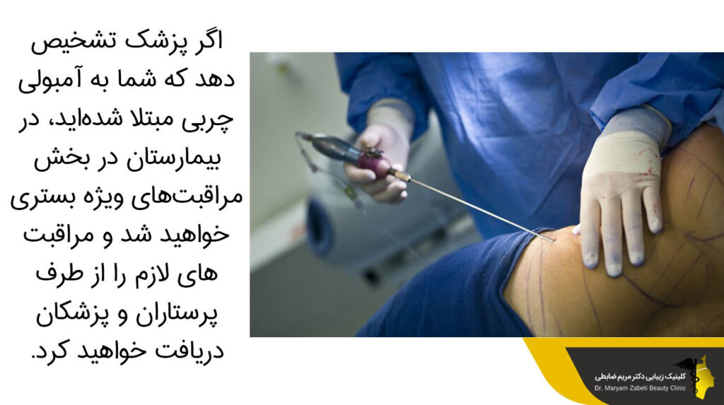 تشخیص پزشک به آمبولی چربی 