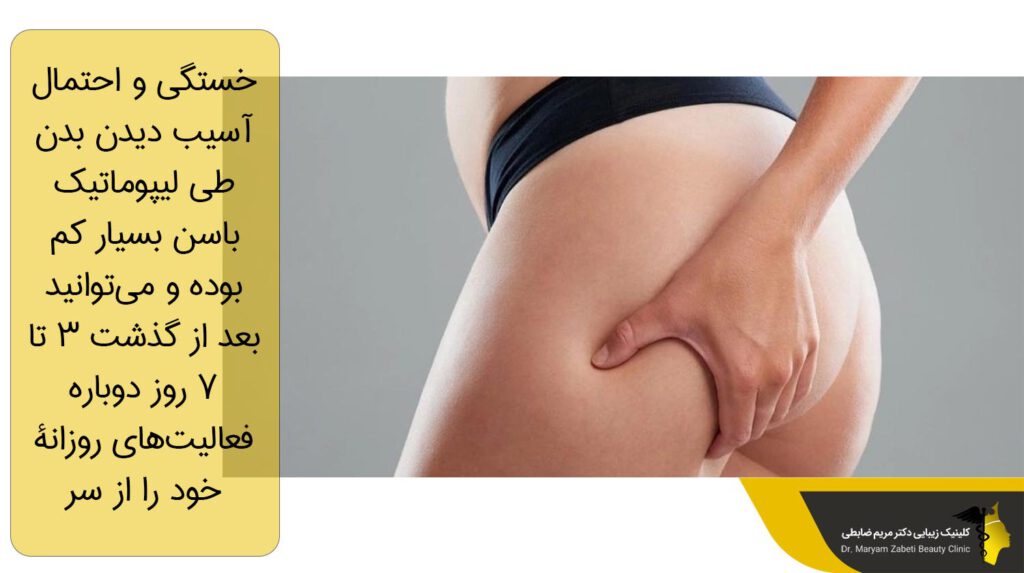 خستگی و احتمال آسیب دیدن بدن طی لیپوماتیک باسن 