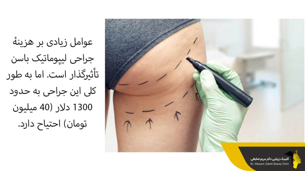 جراحی لیپوماتیک باسن 