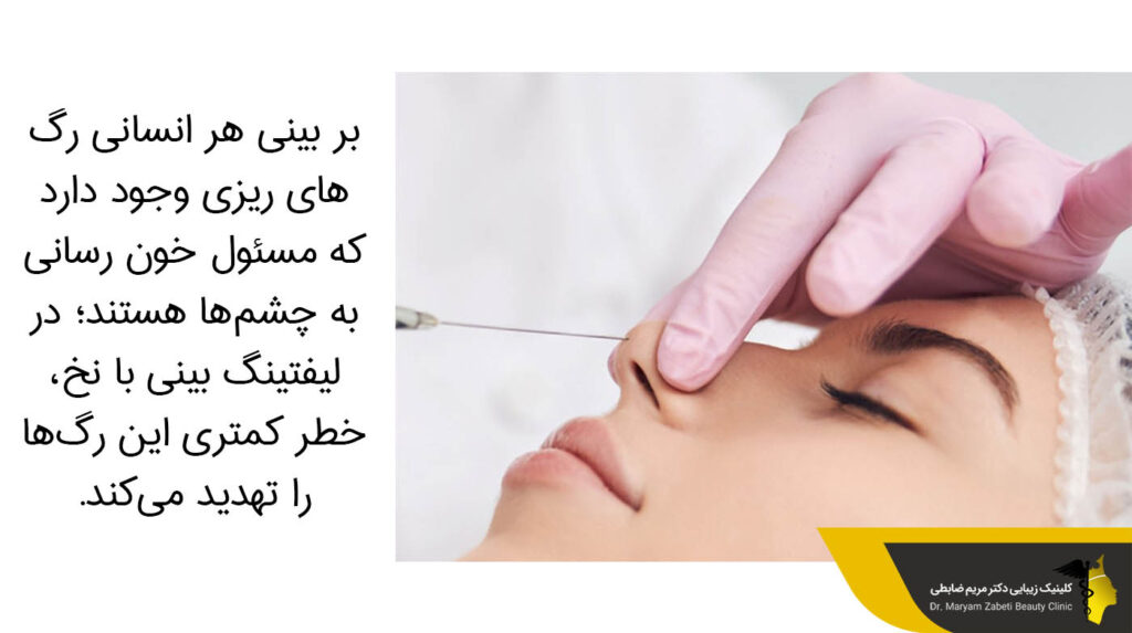 لیفتینگ بینی با نخ