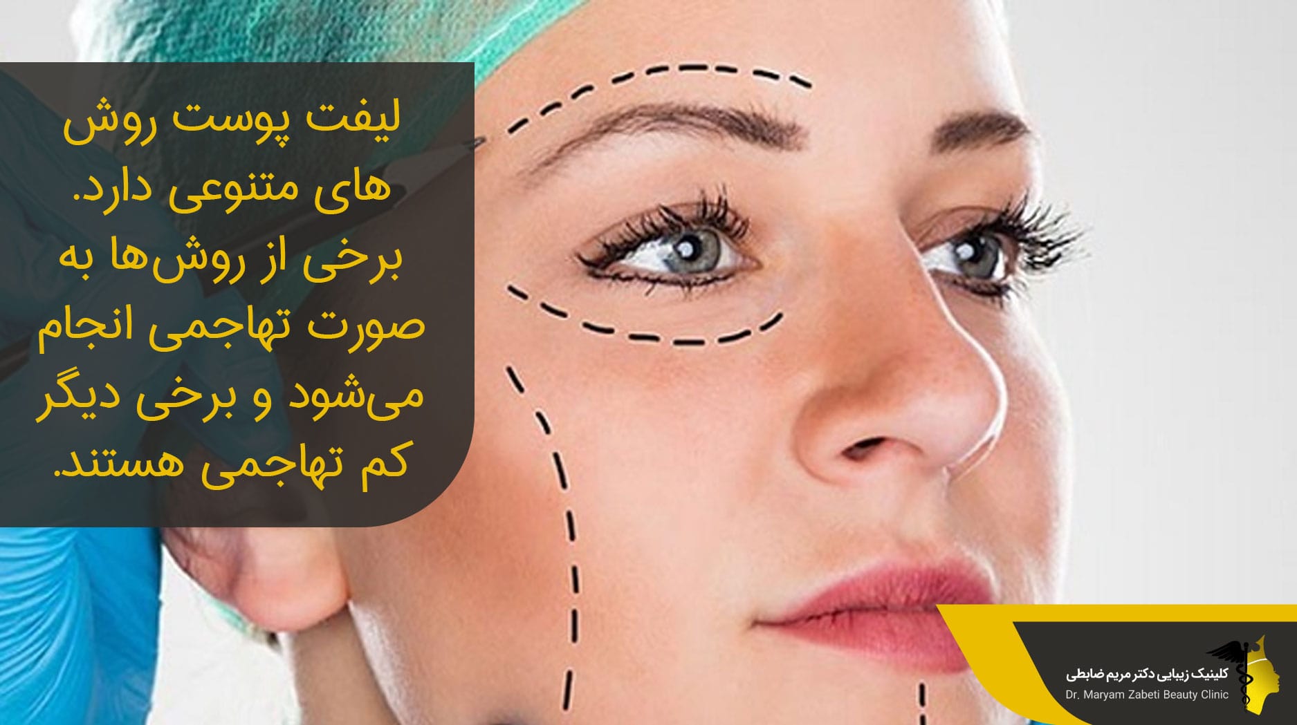 بهترین جراح لیفت صورت تهران