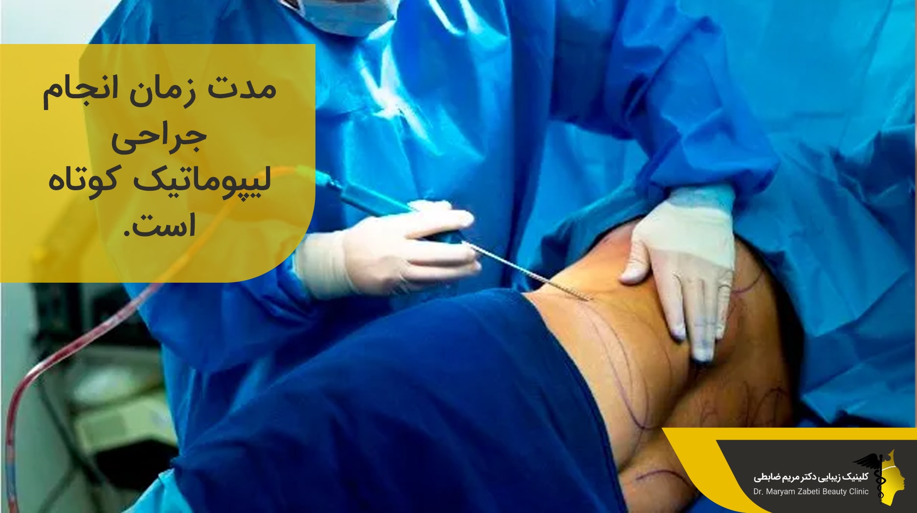 جراحی لیپوماتیک