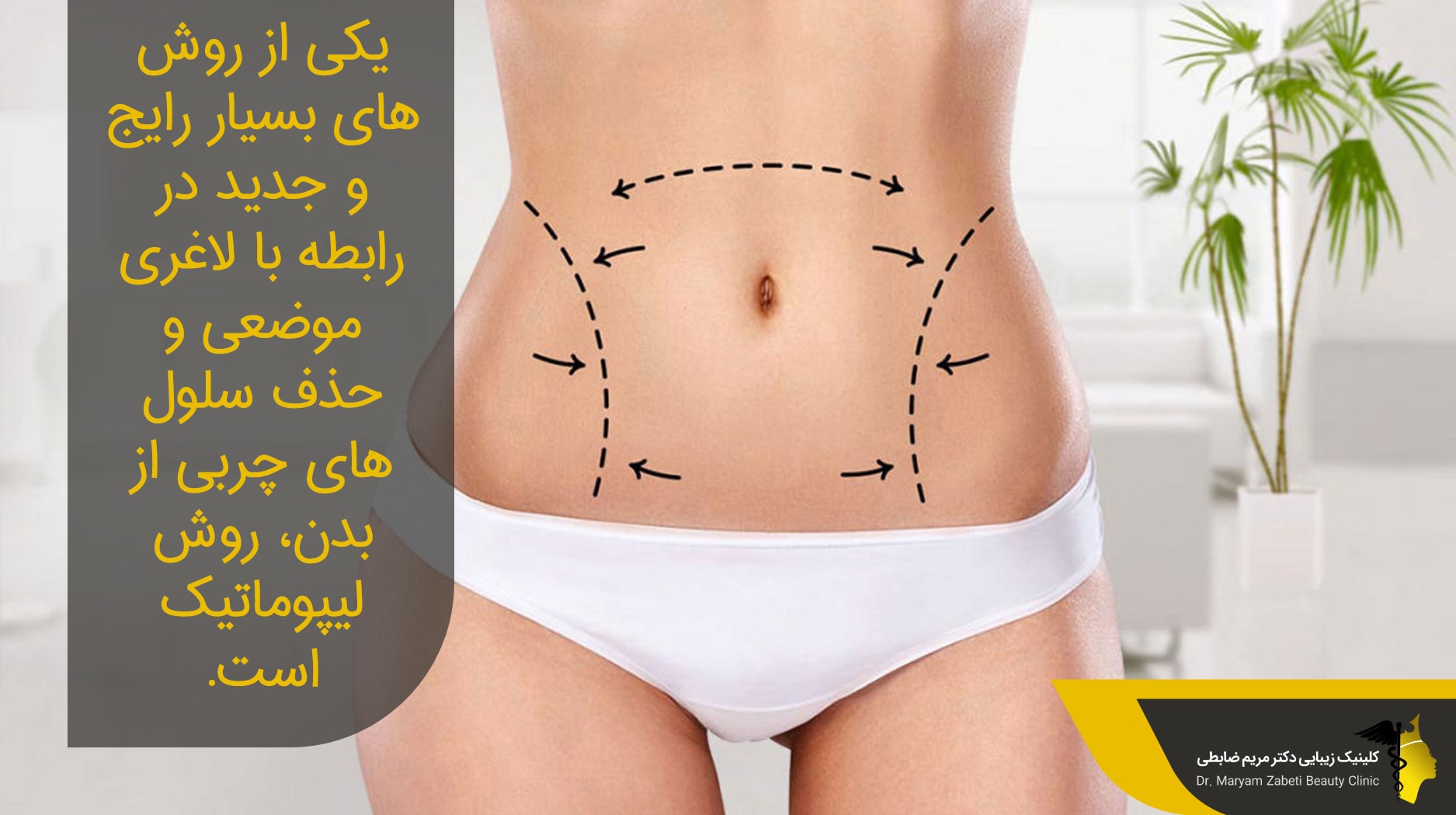 روش لیپوماتیک چیست