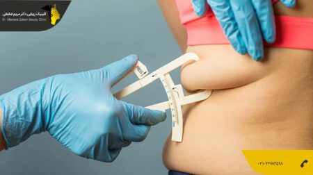 shakheslipo-min (1) تفاوت لیپوماتیک و لیپوساکشن