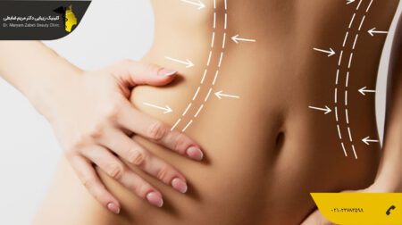 shakheslipo-min (2) فواید لیپوماتیک