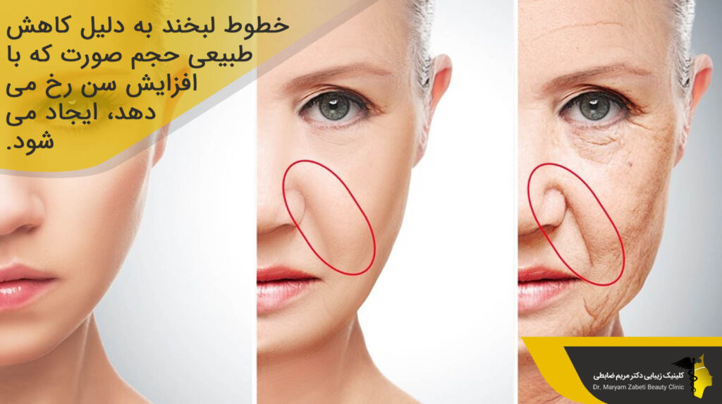 کاهش طبیعی حجم صورت 