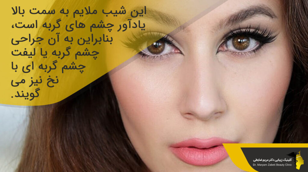 شیب ملایم به سمت بالا چشم گربه ای