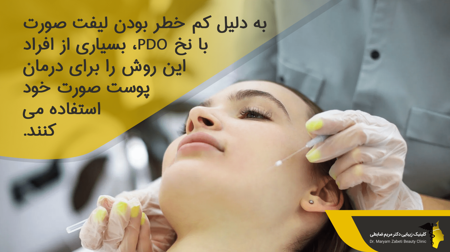 نخ PDO چیست؟