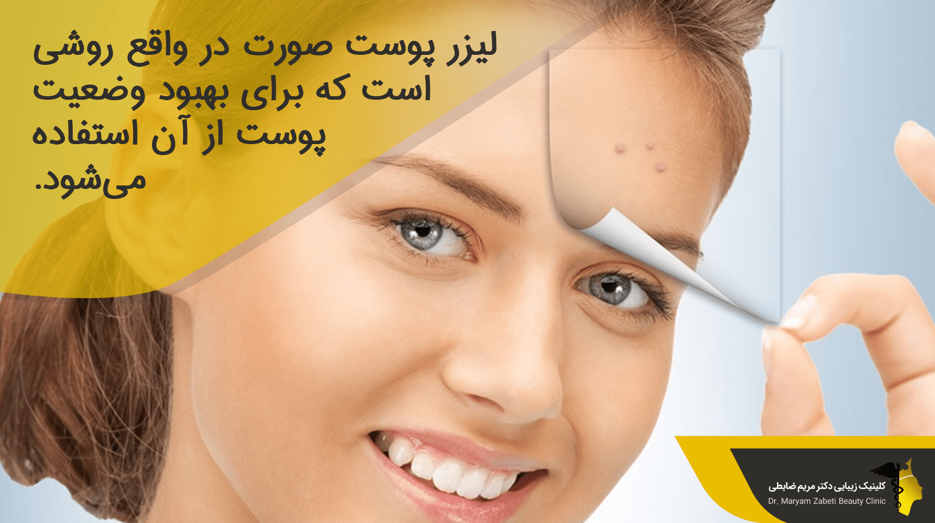 لیزر فرکشنال چیست؟