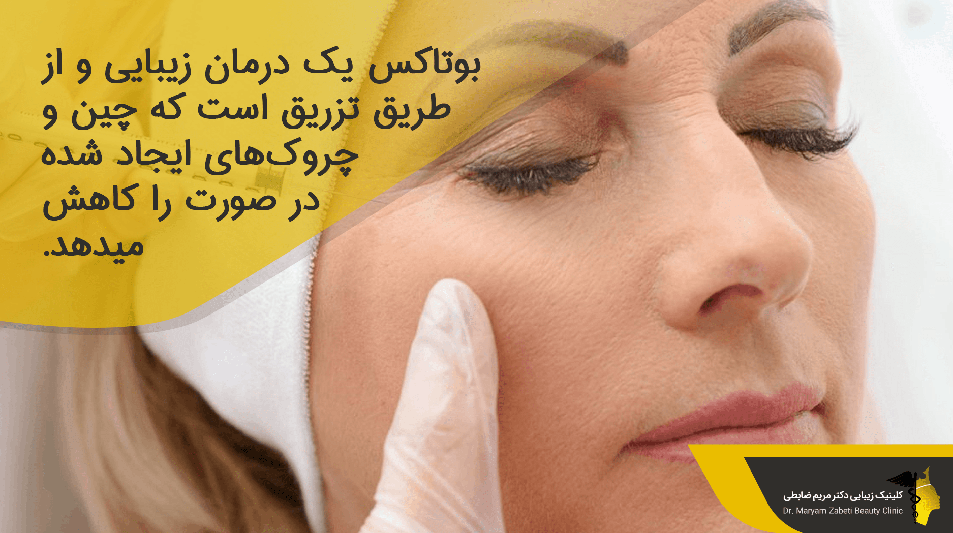 بوتاکس چیست؟ 