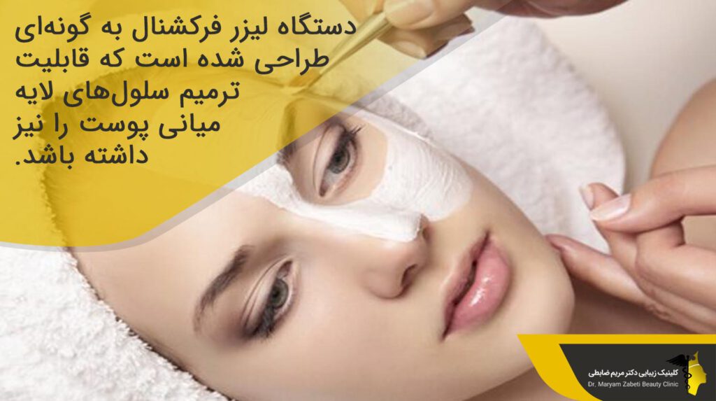 دستگاه لیزر فرکشنال 
