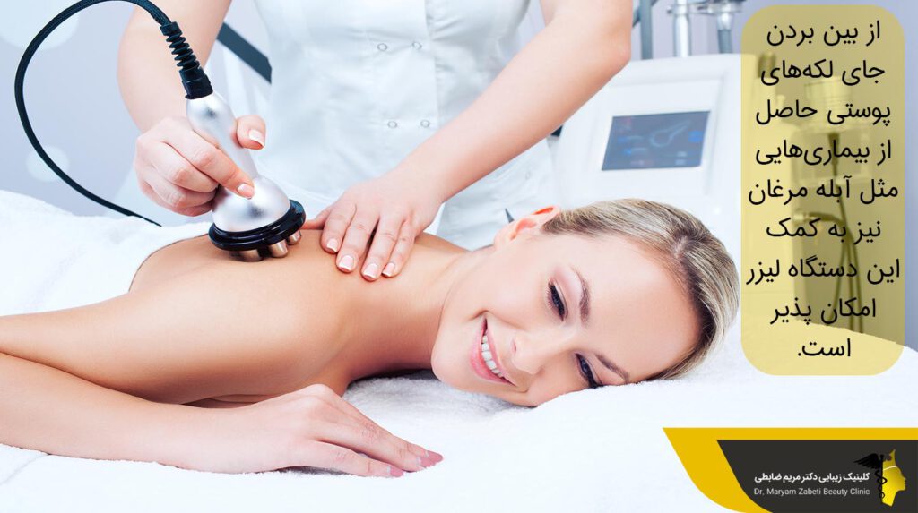 از بین بردن جای لکههای پوستی
