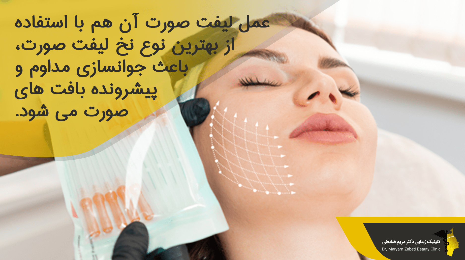 بهترین نوع نخ لیفت صورت
