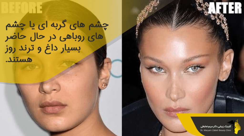 لیفت چشم گربه ای