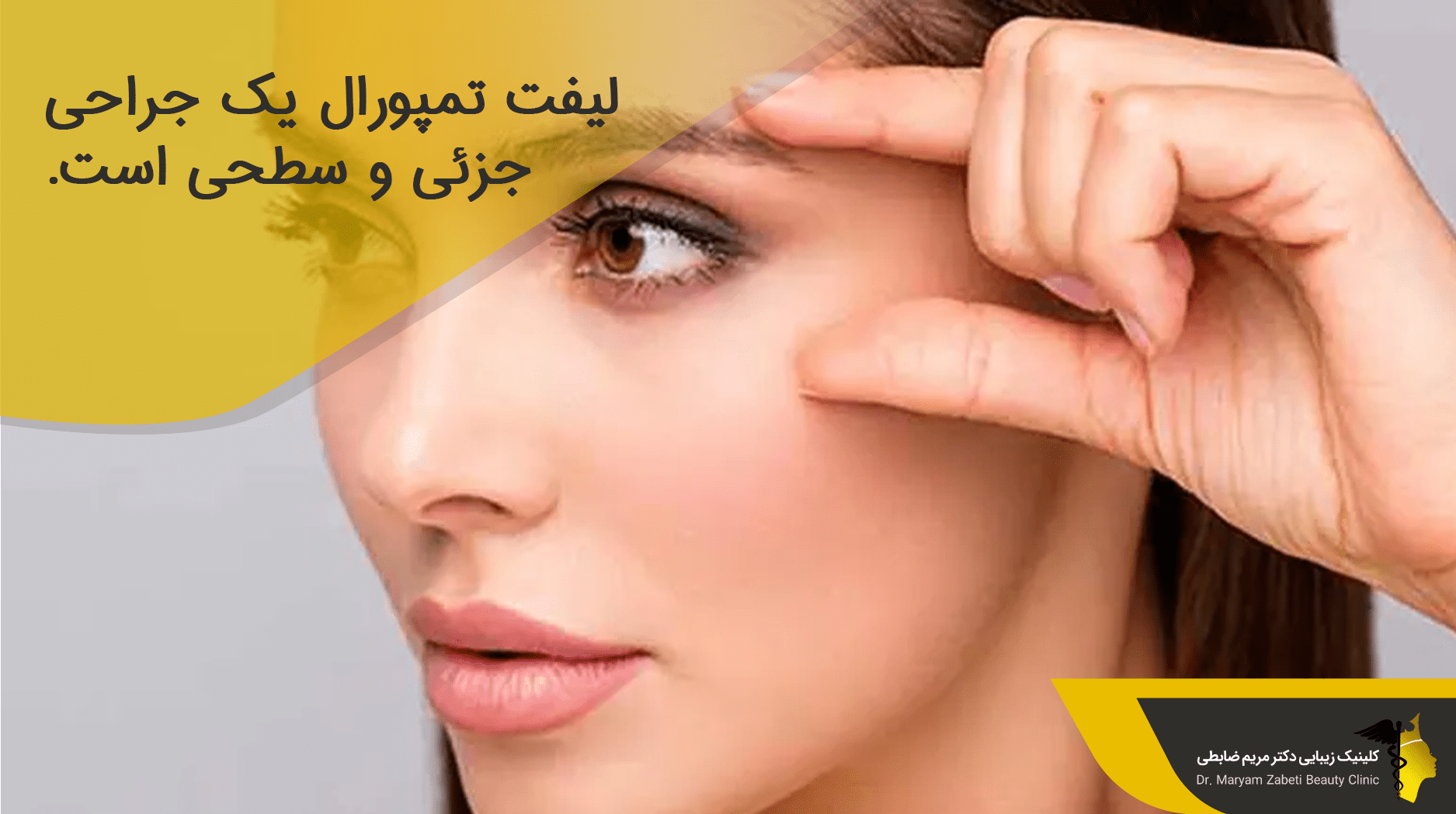 روند انجام لیفت تمپورال