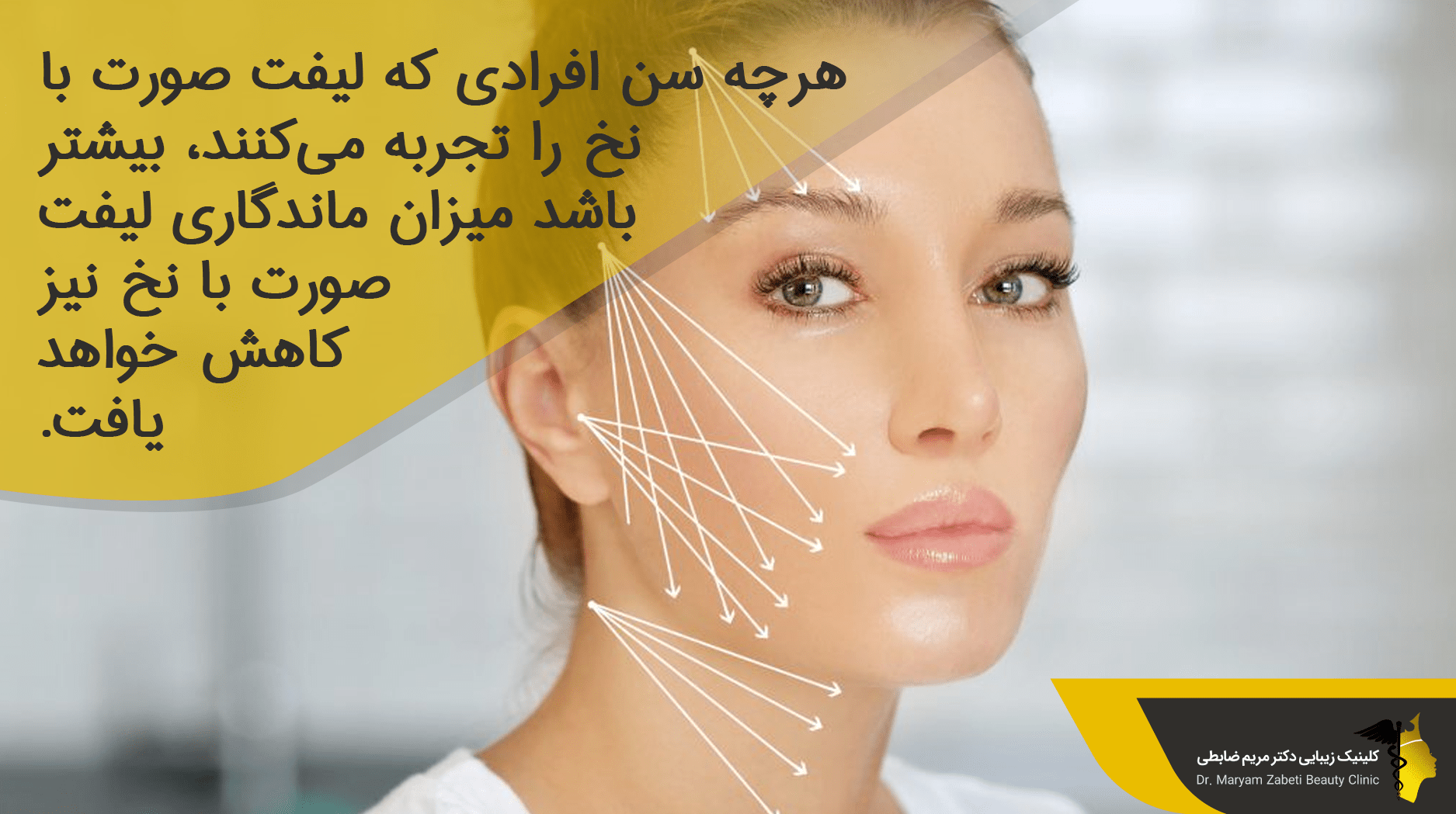 تاثیر سن بر میزان ماندگاری لیفت صورت با نخ