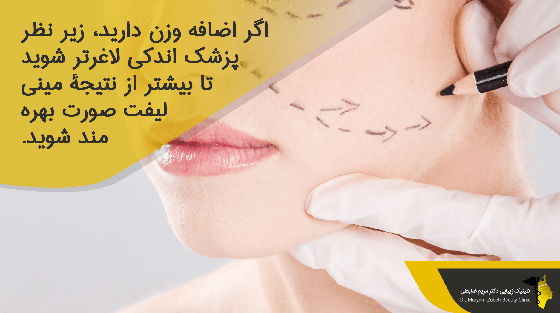 مراقبت‌ های بعد از مینی لیفت صورت 