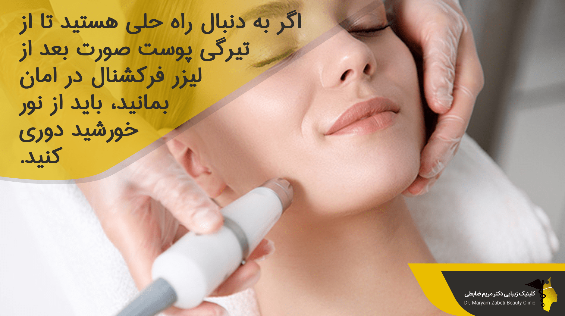 بررسی تیره شدن پوست صورت پس از لیزر فرکشنال