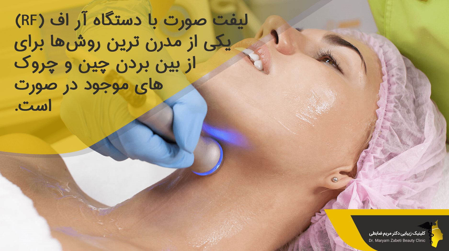 لیفت صورت با دستگاه آر اف