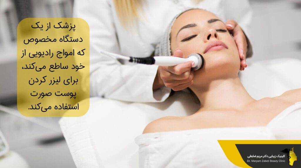 دستگاه مخصوص آر اف