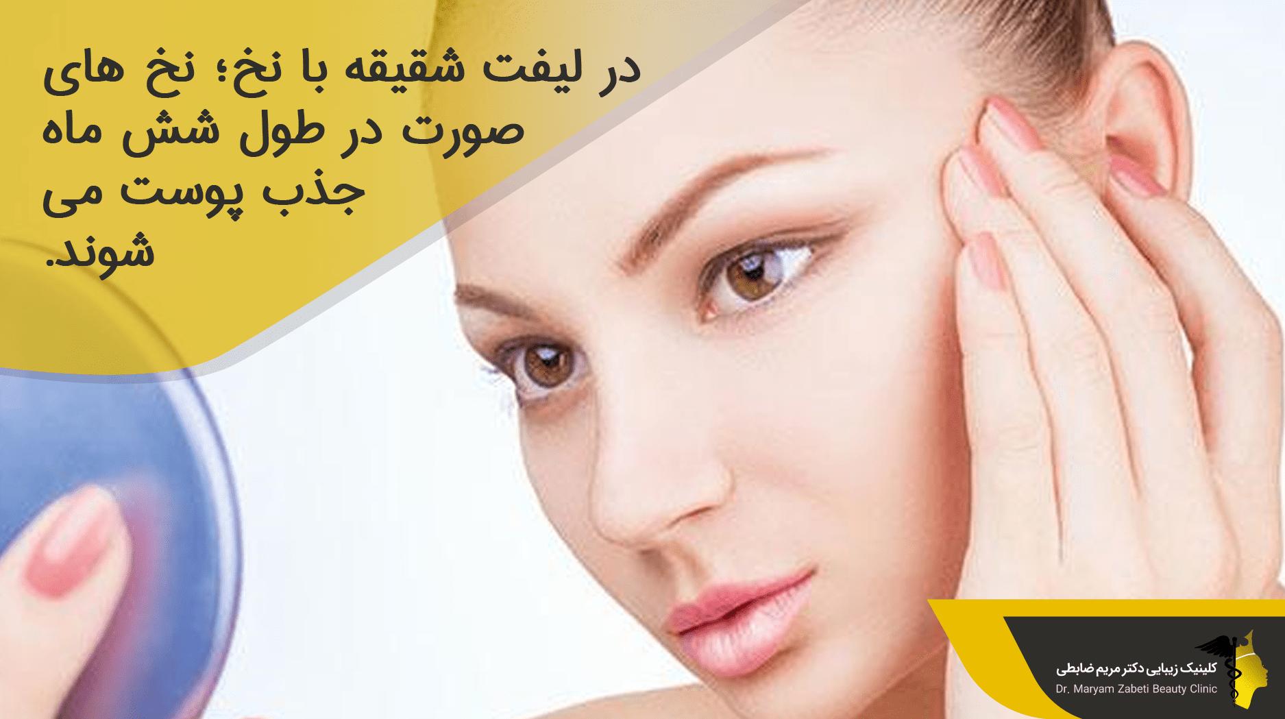 ماندگاری لیفت شقیقه با نخ