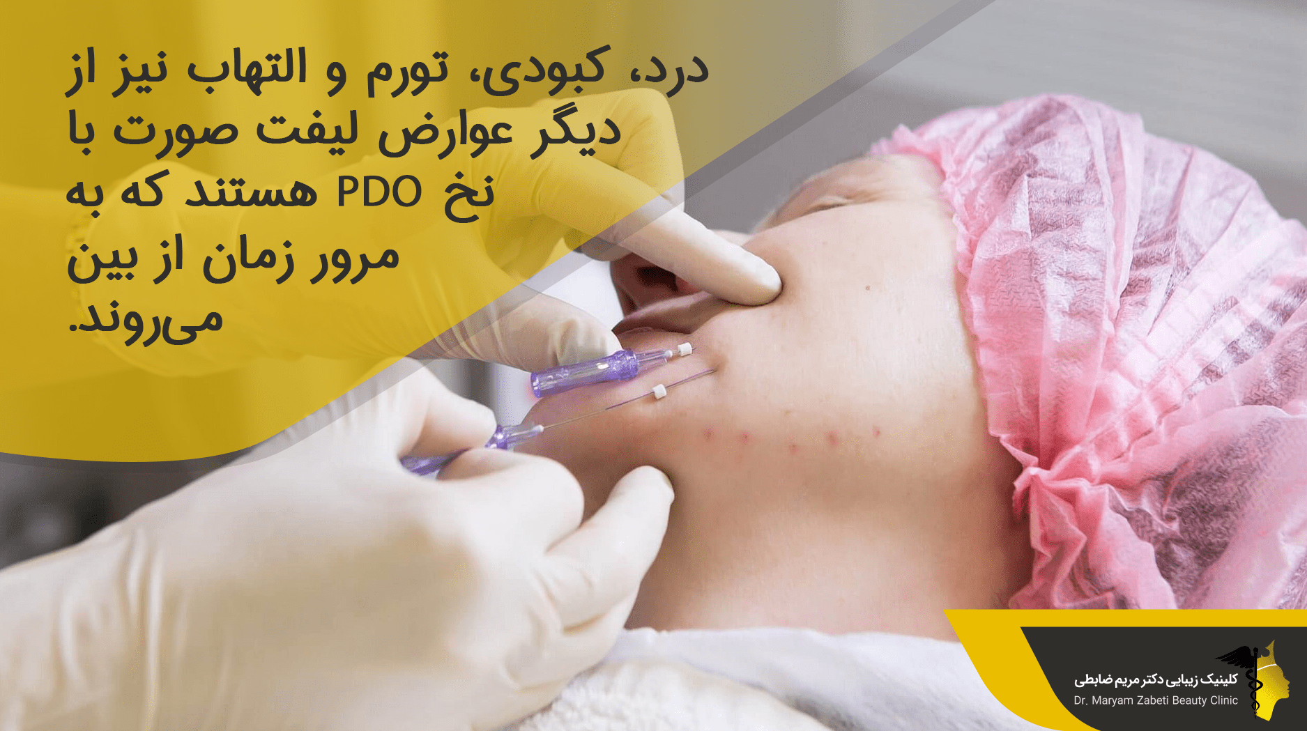 عوارض لیفت صورت با نخ PDO