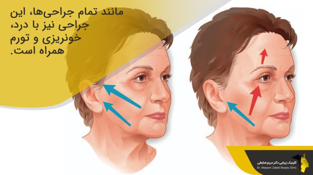 خونریزی و تورم هنگام جراحی