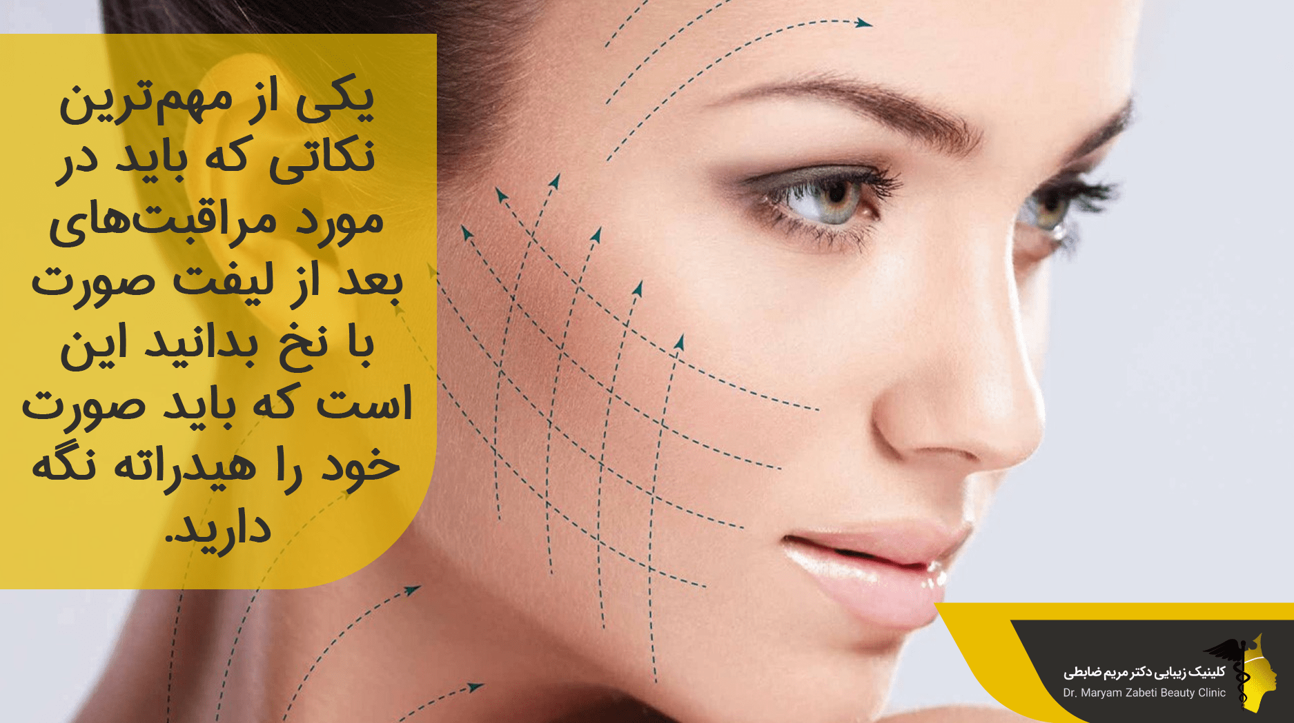 مراقبت بعد از لیفت با نخ