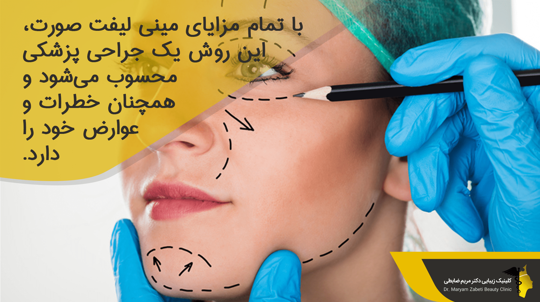 مینی لیفت صورت در مقابل سایر روش ‌های لیفتینگ صورت