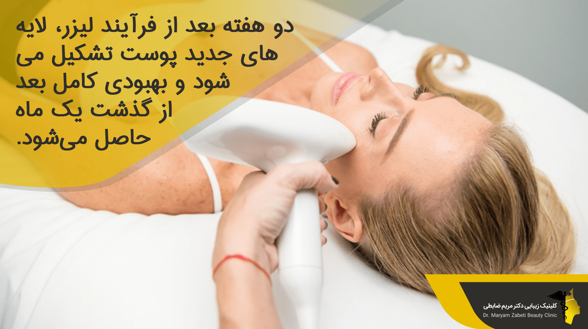 مراقبت ‌های بعد از لیزر فرکشنال