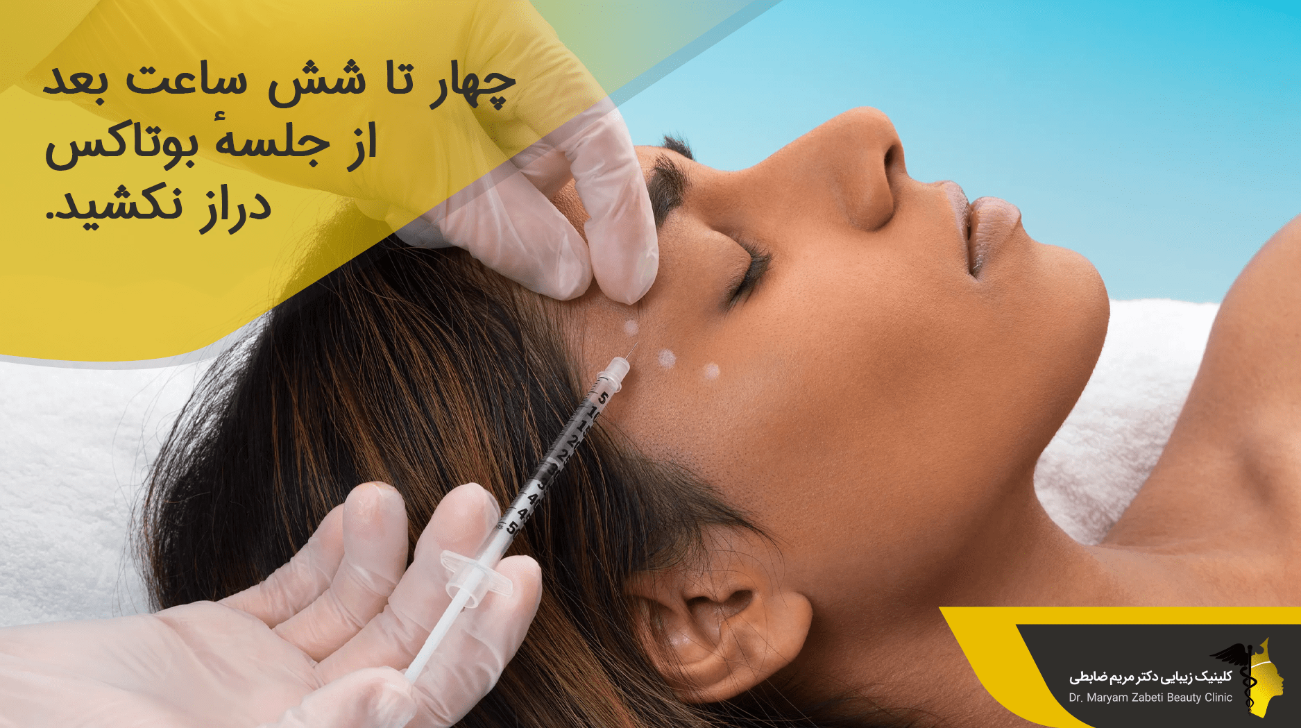 حالت بدن بعد از بوتاکس