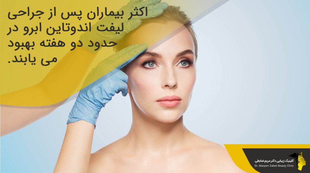 پس از جراحی لیفت اندوتاین 