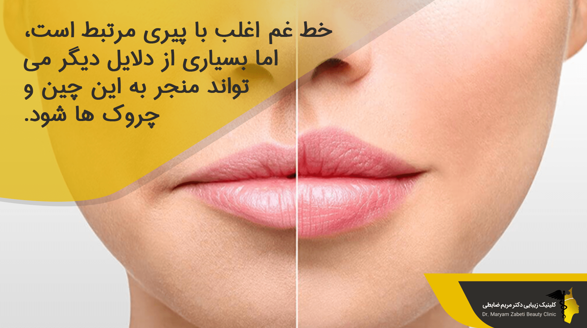 چه چیزی باعث ایجاد خط غم می شود