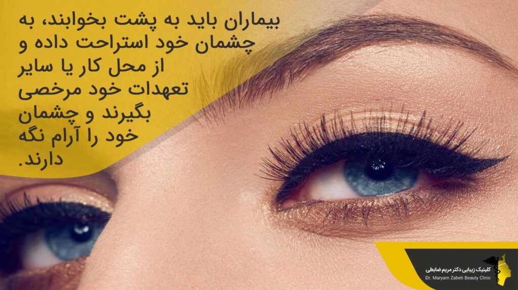عمل کانتوپلاستی چشم