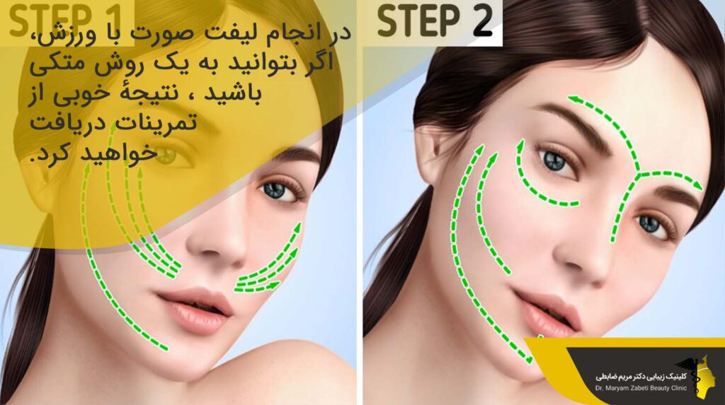 انجام لیفت صورت با ورزش