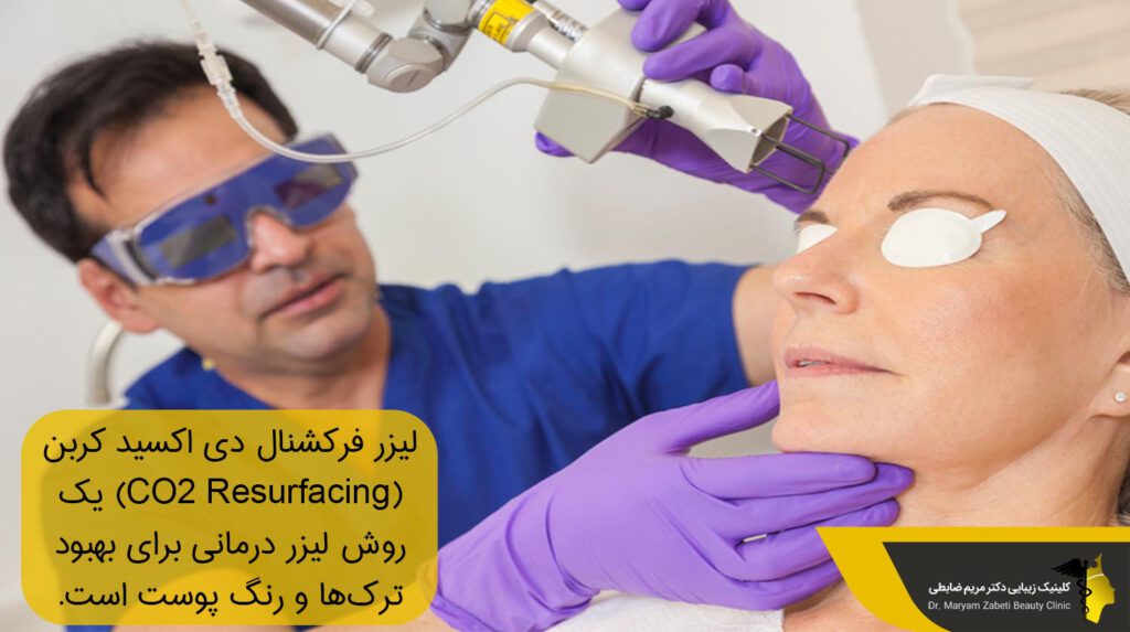 لیزر فرکشنال دی اکسید کربن CO2 Resurfacing