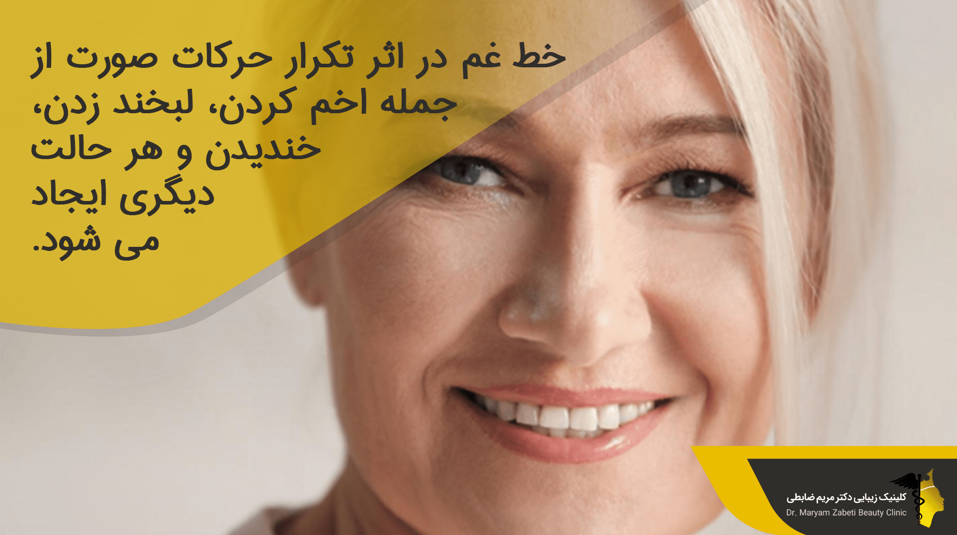 خط اندوه چیست