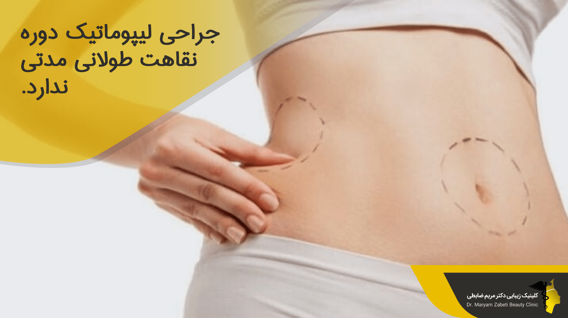 طول دوره نقاهت عمل لیپوماتیک
