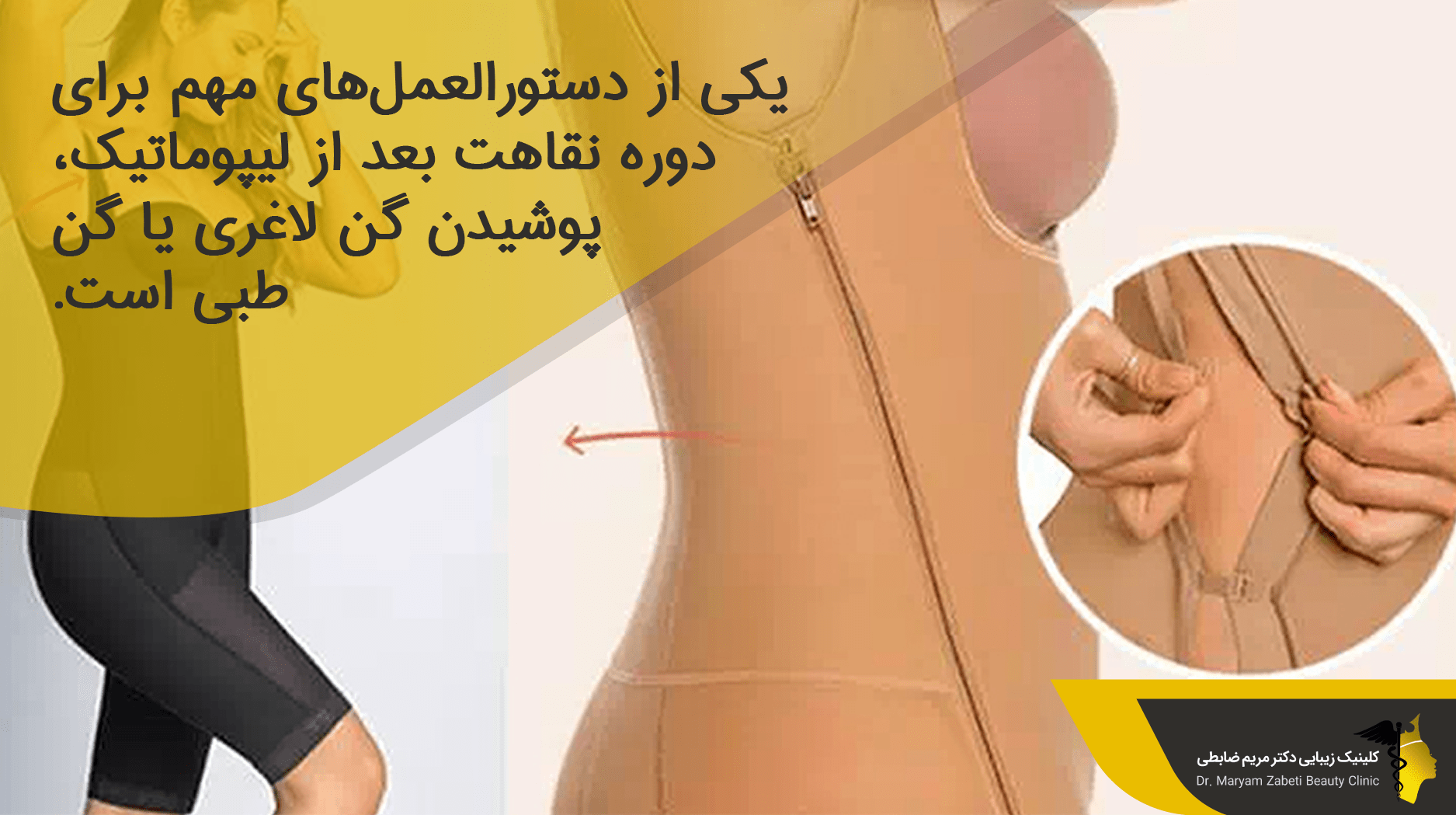 پوشیدن گن طبی بعد از لیپوماتیک