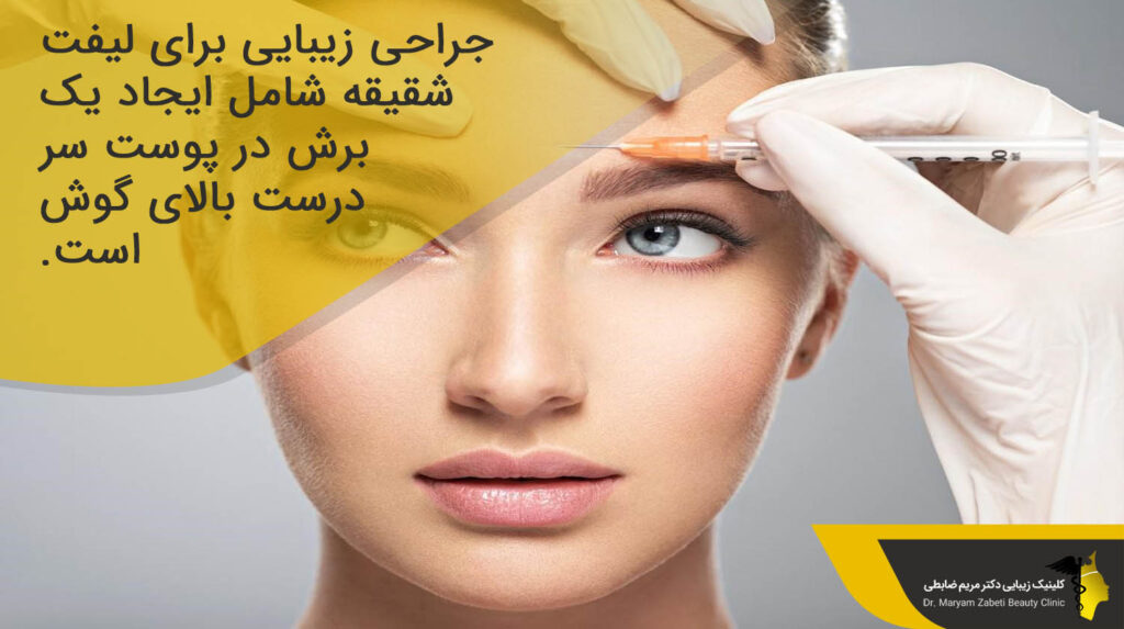 آشنایی با روند جراحی لیفت شقیقه برای شناخت بهترین دکتر لیفت شقیقه در تهران